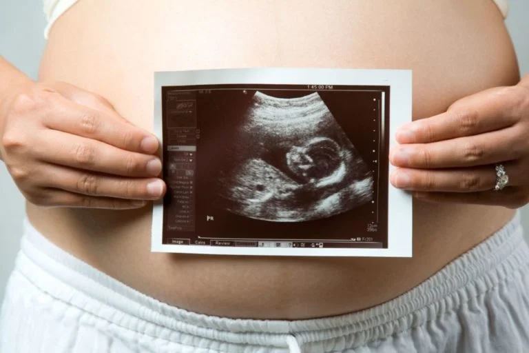 Ultrassons gestacionais: conheça os tipos e esclareça suas dúvidas!